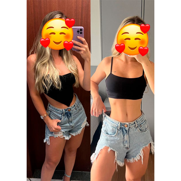 antes-depois4