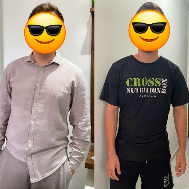 antes-depois7